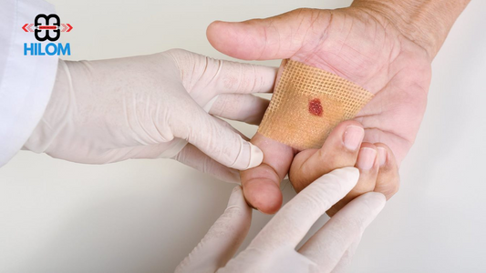 Close-up of a hand with a bandage being applied